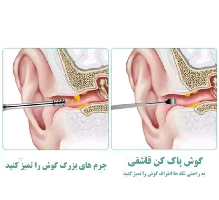 ست گوش پاک کن استیل کیف چرمی وارداتی
